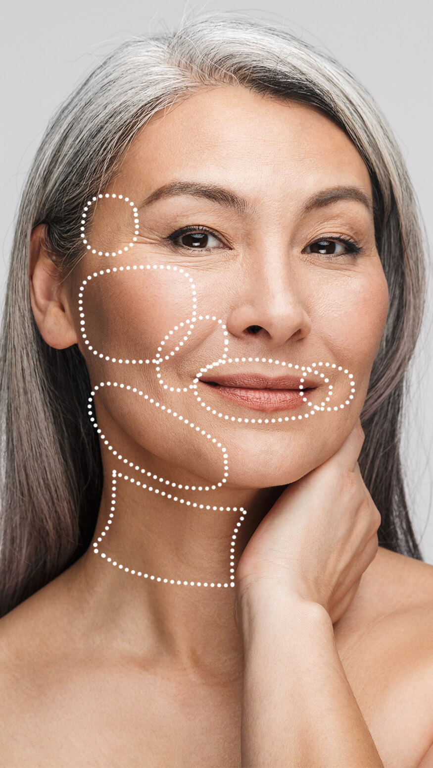 Dermal Fillers | Javivo Aesthetic Clinic in Manchester